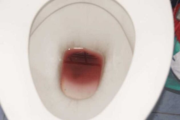 pastebėjimas vyrams susijaudinus